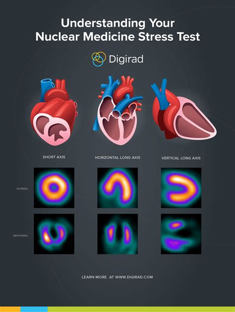 blood pressure drop drastically during nuclear stress test|nuclear stress test abnormal results.